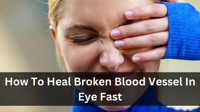 how to heal broken blood vessel in eye fast